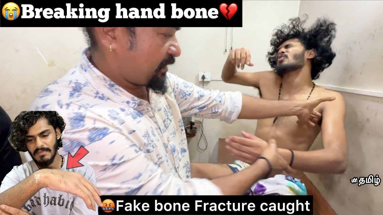 🤬My Fake bone fracture caught by him so 😭They breaking my bone💔| This is very painful 😰 | TTF |