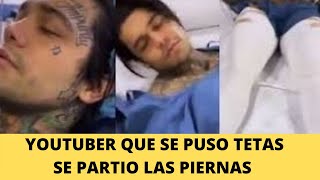 Que Le Paso Al Influencer Que Se Puso Tetas