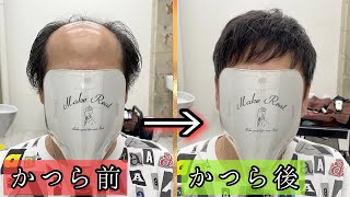 [かつら・ウィッグ]良い意味でえげつない生え際とフィット感、そして透け感。