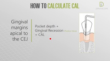 Dentiscope | HOW TO DETERMINE CLINICAL ATTACHMENT LOSS