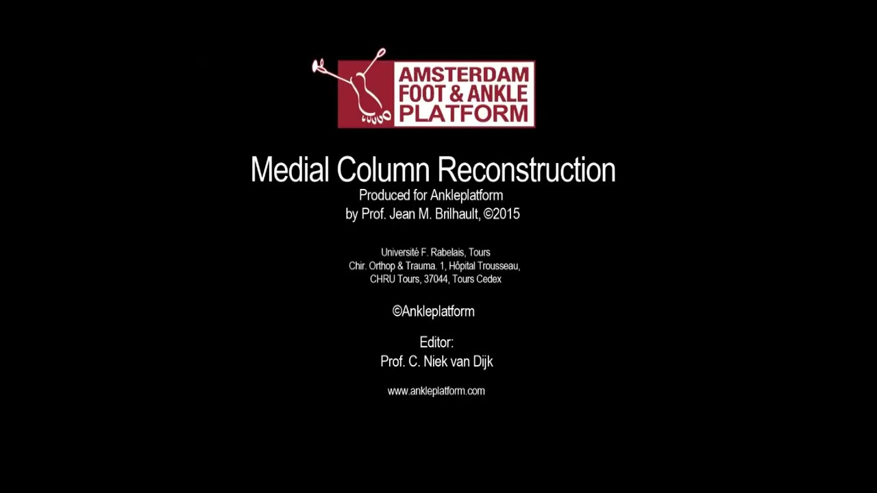 Medial Column Reconstruction