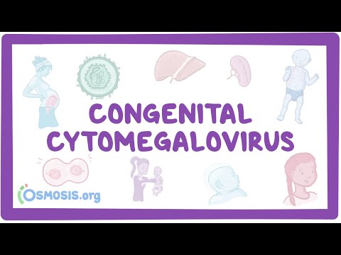 Congenital CMV - causes, symptoms, diagnosis, treatment, pathology