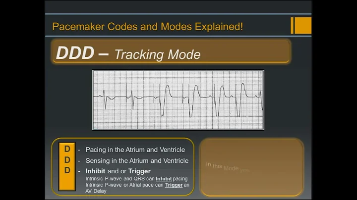 Pacemaker Codes and Modes - Explained