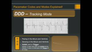 Pacemaker Codes and Modes - Explained