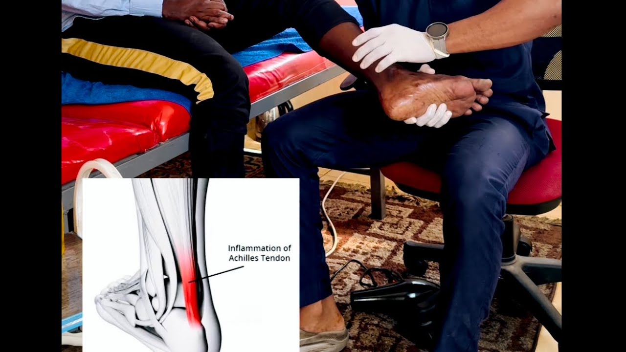 Cirba xanuunka maxaa keeno.