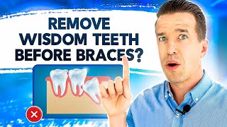 Do Wisdom Teeth Make Your Teeth Crooked?
