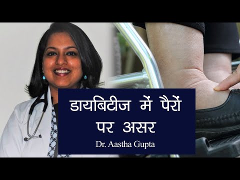 Diabetic Foot Problems: Symptoms, Treatment| डायबिटीज में पैरों की देखभाल कैसे करें| Dr Aastha Gupta