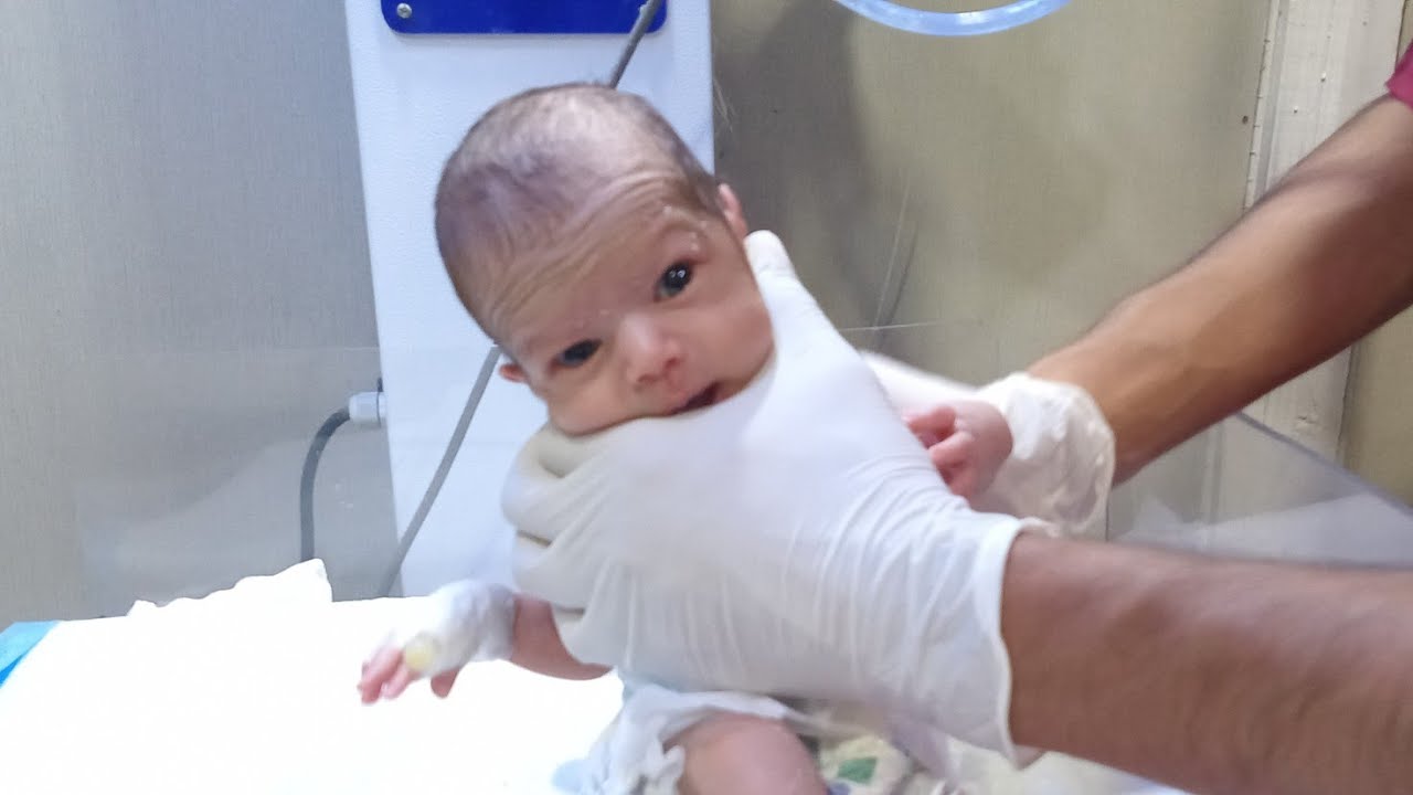 Abdominal Distension pain NICU Baby procedure completely  care...