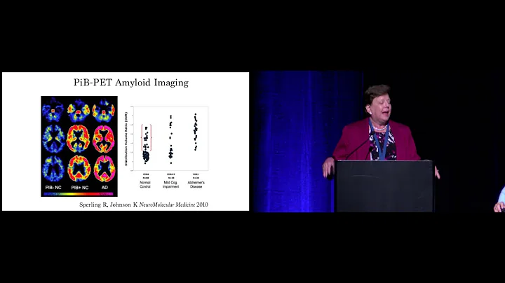 Recent Advances in the Early Detection of Alzheimer's Disease