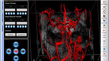GPU-based point radiation for interactive volume sculpting and segmentation