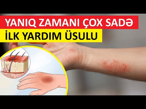 Video: Bitkilər və Qaynar Su - Bağda Qaynar Sudan Necə İstifadə Edilir