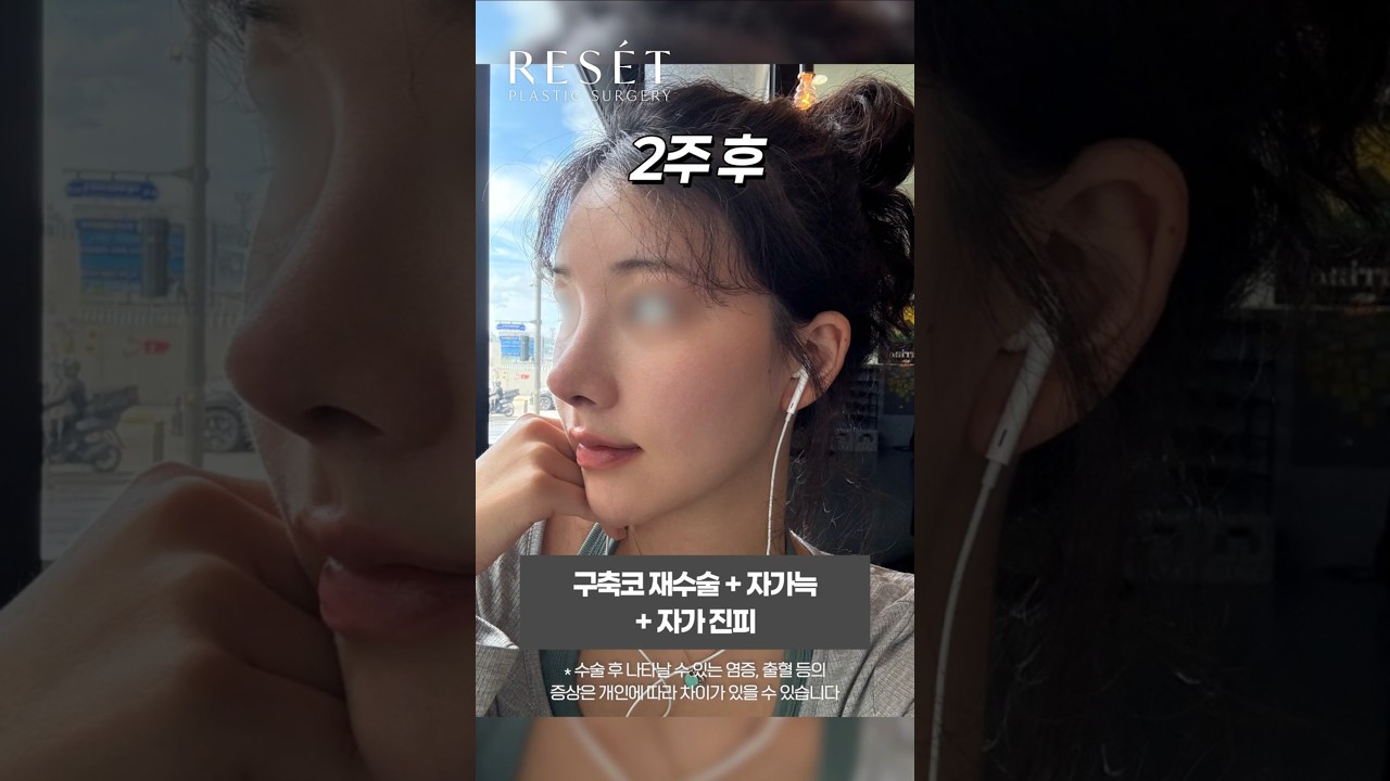 등록한썸네일