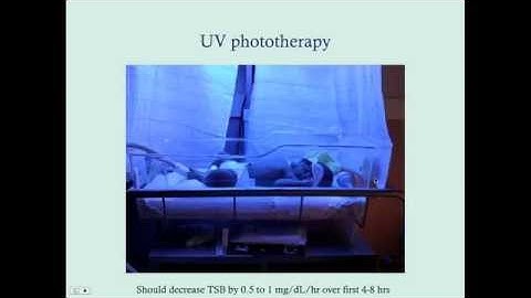 Newborn Indirect Hyperbilirubinemia - CRASH! Medical Review Series