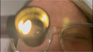 Lofi Detailed Cranial Nerve Exam For Members-Only Light Visual Triggers For Tingle Immunity