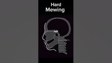 How To Do Hard Mewing 🤫 | Day 25 | 30 Day