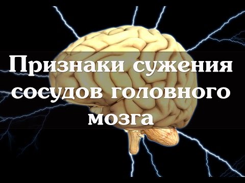 Признаки сужения сосудов головного мозга