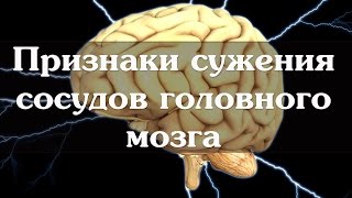 видео Гипоксия головного мозга: симптомы, признаки, причины, лечение и последствия