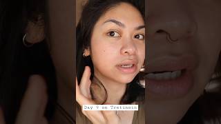 Day 9 on Tretinoin : How much can your skin tolerate?