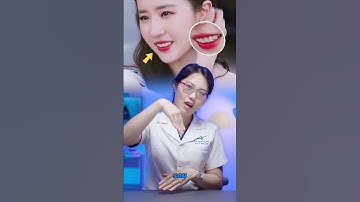 Nụ cười của Lưu Diệc Phi xứng đáng mấy điểm nào? | Lạc Việt Intech Niềng Răng #shorts