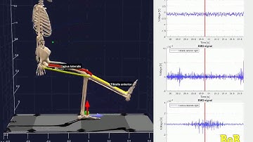 EMG and IMU sensors