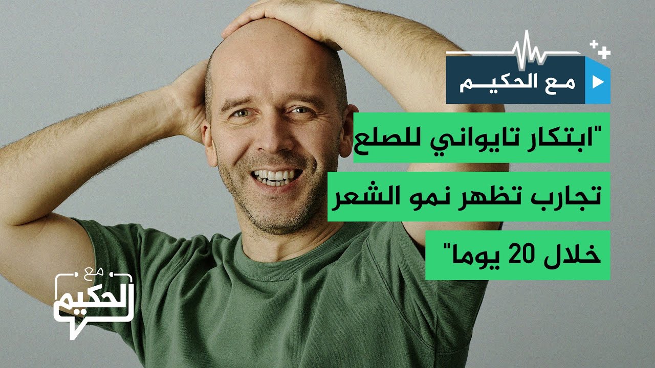 "ابتكار تايواني لمكافحة الصلع..  وتجارب تظهر نمو الشعر خلال 20 يوما"