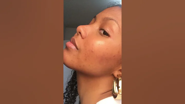 Results after using our Lactic Acid & Vitamin C Serum! 💛🧡