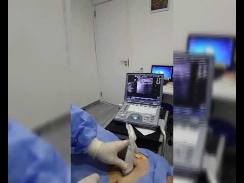 ვაკუუმ რეზექცია - Breast Vacuum Resection