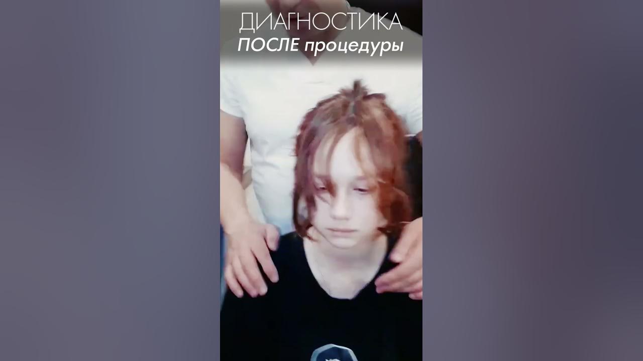 Как снять блок атланта Недоворот головы конкретный! Натяжение в поясницу. Блок атланта. Акупрессура под