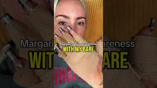 Margaritas Gave Her Second Degree Burns 😱 🎥 @princess__peacock