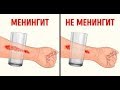 МЕНИНГИТ деген не??? Рекомендации СЕМЕЙНОГО ВРАЧА