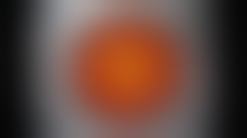 Glued IOL   #retina  eye surgery