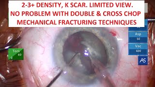 TBWTDCS #180: 2-3  DENSITY, K SCAR. NO PROBLEM WITH DOUBLE & CROSS CHOP. MECHANICAL FRACTURIN