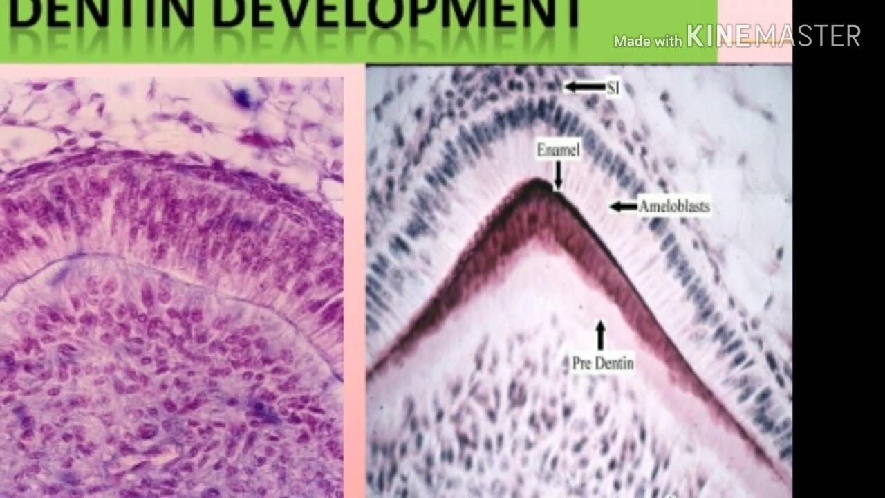 Dentin development of dentin dentinogenesis mantle dentin