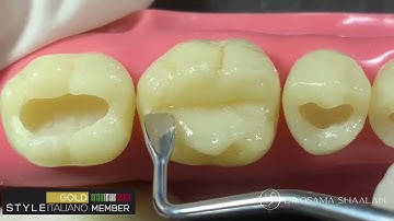 Lm arte Replica posterior by Styleitaliano - Replica of lower 6