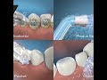 why waterpik aquarius is the gold standard