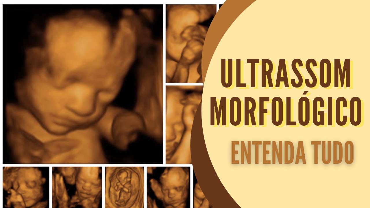 ULTRASSOM MORFOLÓGICO: O que é? Quando fazer? Como é feito? Onde Fazer ...