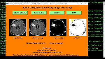 Python Code On Brain Tumor Detection Using Image Processing full Source Code | IEEE Based Projects