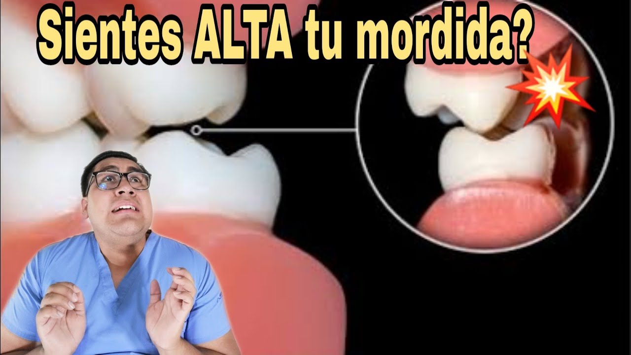 LO QUE TU DENTISTA NO TE DEBERIA DECIR SI TE QUEDO ALTA TU RESINA O ALGUNA RESTAURACION