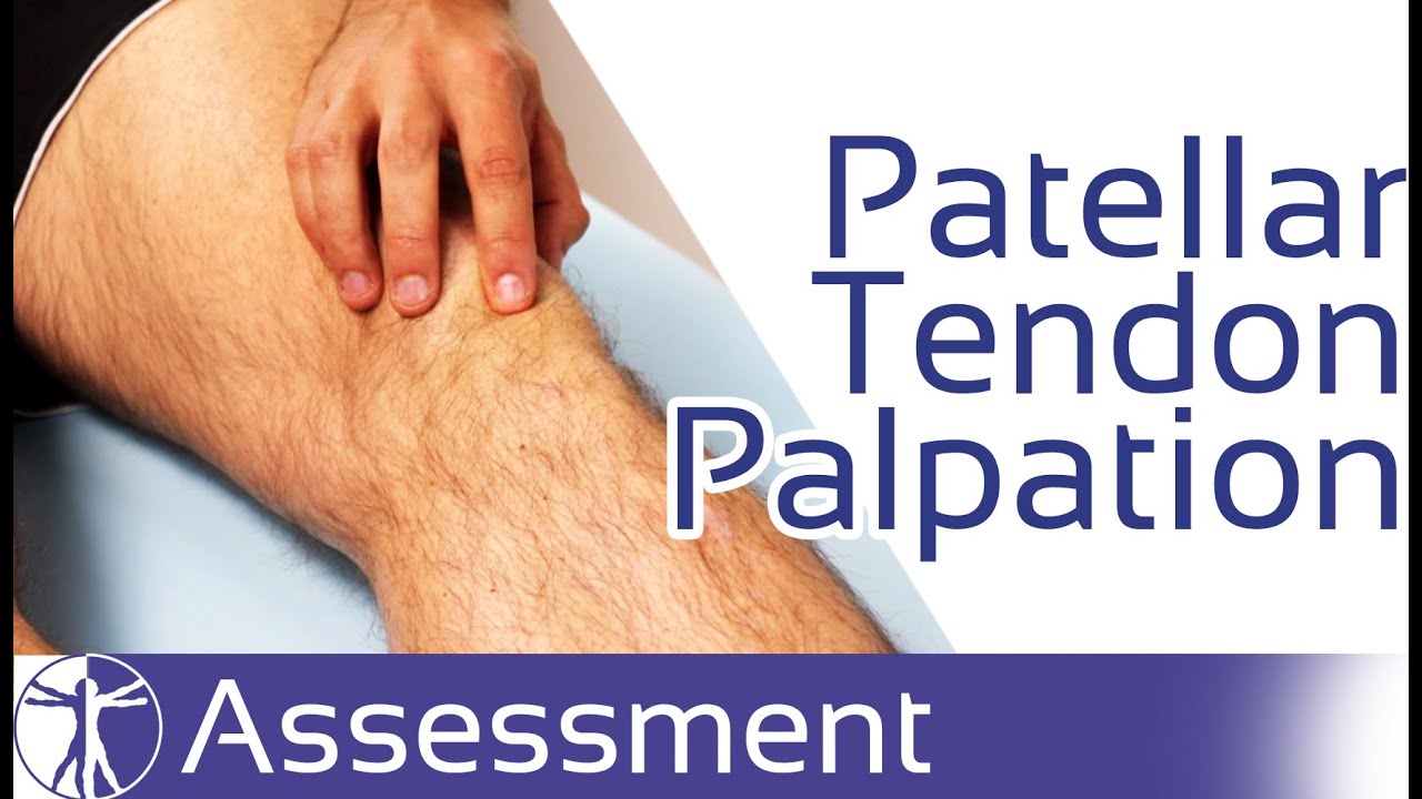 Patellar Tendon Palpation  Patellar Tendinopathy 