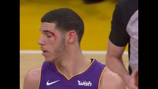 Lonzo ball injury - warriors vs lakers | nov 29, 2017 ximo pierto nba
2017-18 hd