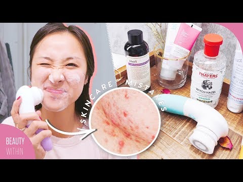  Skincare MISTAKES That Can Make ACNE & Large PORES Worse! (Ft. Wishtrend TV)