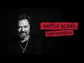Bam Margera Battle Scars | Worst Injury Stories