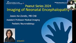 Imaging Neonatal Encephalopathy  --  Dr.  Jessie Aw-Zoretic --  1.25.2024