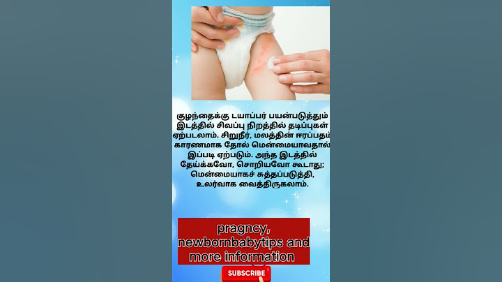 குழந்தைக்கு போடும் டயபாரால் ஏற்படும் சிவப்பு தடிப்பு diaper rash