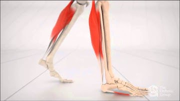 Biomechanix Clinic Ltd - Ankle Equinus