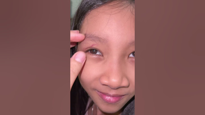 P1 - Con chó Báo Đời 🥴🥹#samchannel #shorts