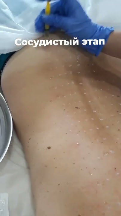 ⚜Стимуляция кровообращения, нормализация венозного оттока,укрепление ...