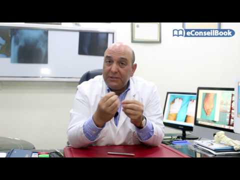 Dr. Ali EL KOHEN : Dr. Ali EL KOHEN : كيف تتخلص من مشكل اعوجاج أصبع القدم الكبير؟ - Dr. Ali EL KOHEN : Dr. Ali EL KOHEN : كيف تتخلص من مشكل اعوجاج أصبع القدم الكبير؟