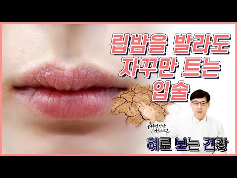 박탈성 구순염/ 입술이 트고 갈라지고 아플때 보세요