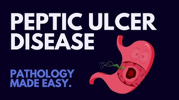 Peptic Ulcer Disease l Pathology Made Easy